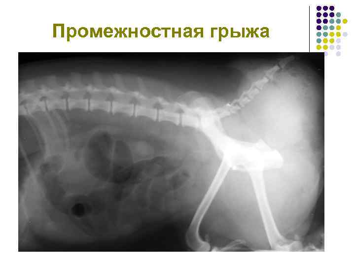 Промежностная грыжа 