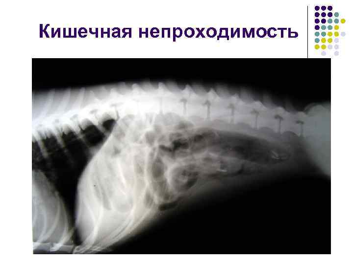 Кишечная непроходимость 