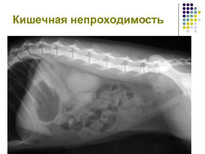 Кишечная непроходимость 