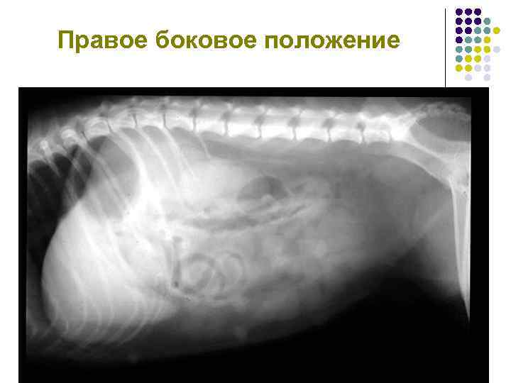 Правое боковое положение 