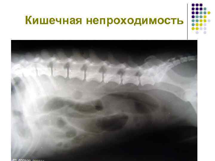 Кишечная непроходимость 