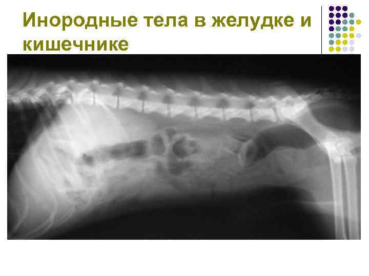 Инородные тела в желудке и кишечнике 