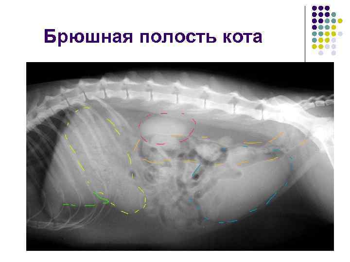 Брюшная беременность фото