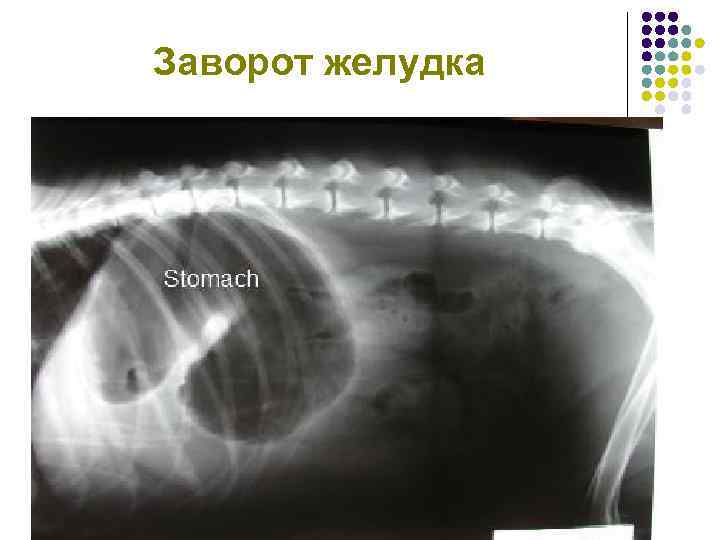 Заворот желудка 