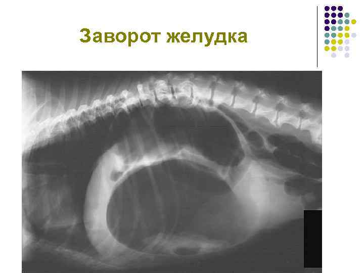 Функциональный фон в брюшной полости