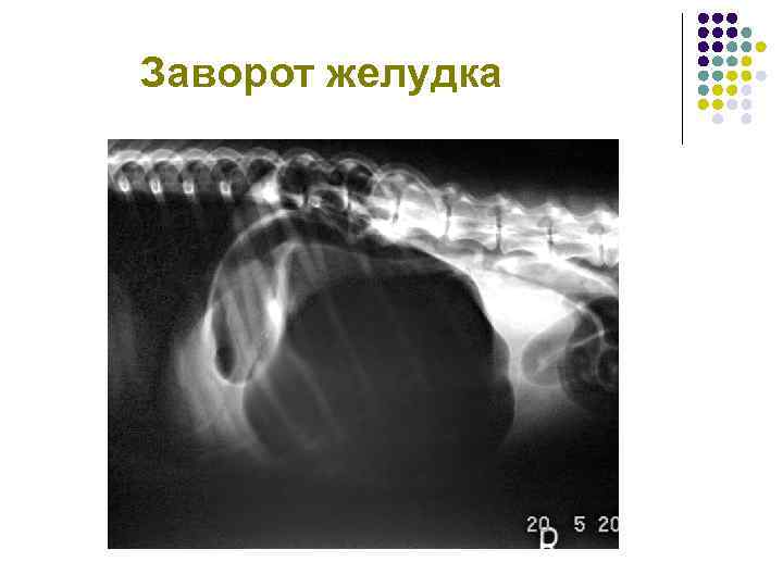 Заворот желудка 