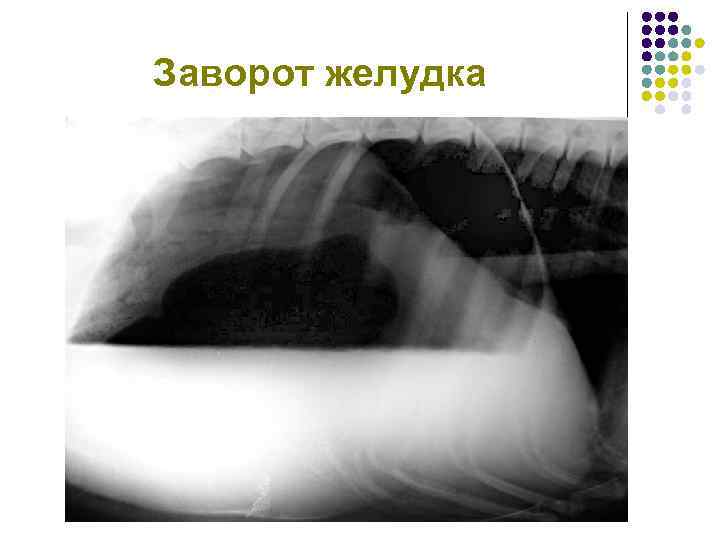 Заворот желудка 