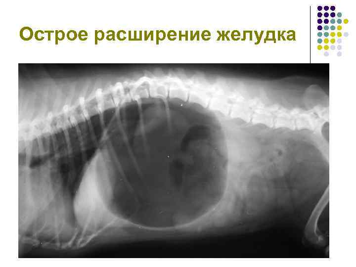 Функциональный фон в брюшной полости