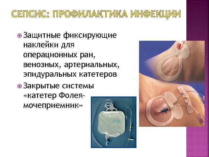 СЕПСИС: ПРОФИЛАКТИКА ИНФЕКЦИИ Защитные фиксирующие наклейки для операционных ран, венозных, артериальных, эпидуральных катетеров Закрытые