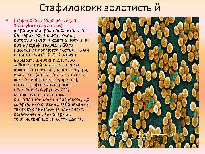 Стафилококк золотистый • Стафилококк золотистый (лат. Staphylococcus aureus) — шаровидная грамположительная бактерия рода стафилококк,