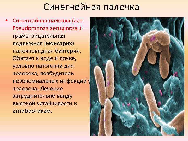 Синегнойная палочка • Синегнойная палочка (лат. Pseudomonas aeruginosa ) — грамотрицательная подвижная (монотрих) палочковидная