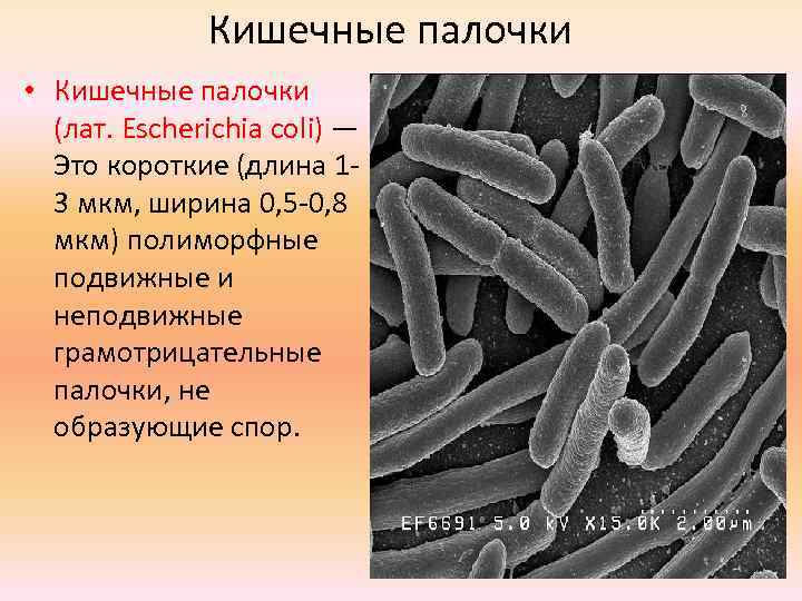 Кишечные палочки • Кишечные палочки (лат. Escherichia coli) — Это короткие (длина 13 мкм,