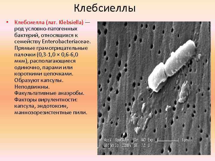 Клебсиеллы • Клебсиелла (лат. Klebsiella) — род условно-патогенных бактерий, относящихся к семейству Enterobacteriaceae. Прямые