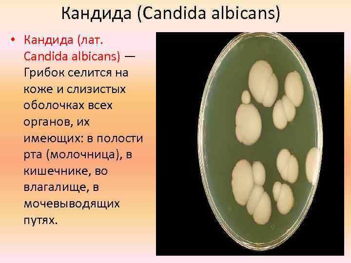 Кандида (Candida albicans) • Кандида (лат. Candida albicans) — Грибок селится на коже и