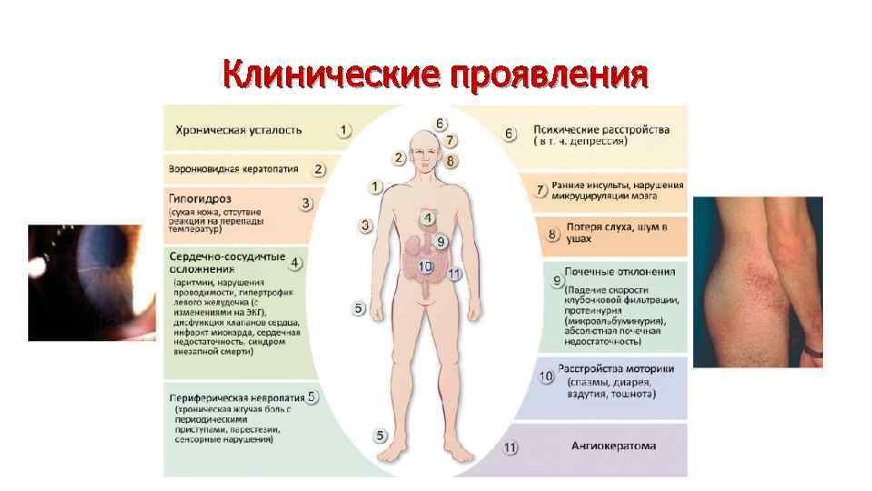 Клинические проявления 