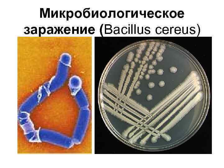 Микробиологическое заражение (Bacillus cereus) 