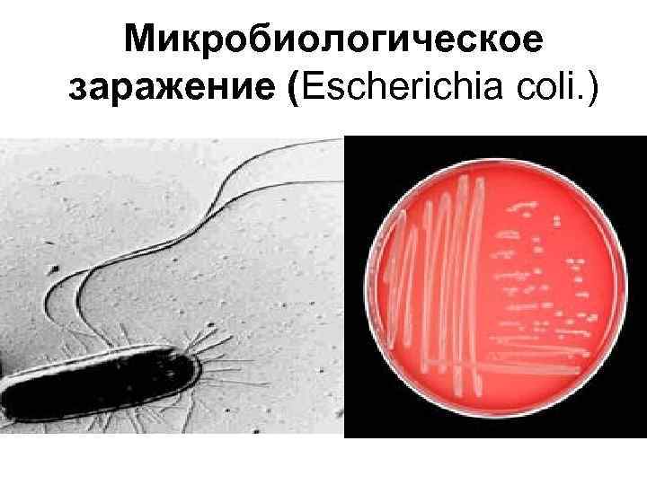 Микробиологическое заражение (Escherichia coli. ) 