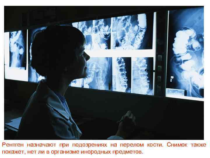 Рентген назначают при подозрениях на перелом кости. Снимок также покажет, нет ли в организме