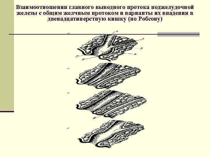 Взаимоотношения главного выводного протока поджелудочной железы с общим желчным протоком и варианты их впадения