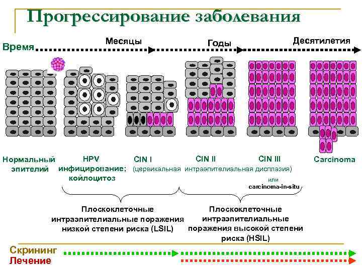 Прогрессирование заболевания Месяцы Время Десятилетия Годы HPV CIN III Нормальный CIN I эпителий инфицирование;