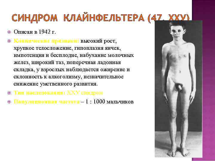 СИНДРОМ КЛАЙНФЕЛЬТЕРА (47, ХХУ) Описан в 1942 г. Клинические признаки: высокий рост, хрупкое телосложение,