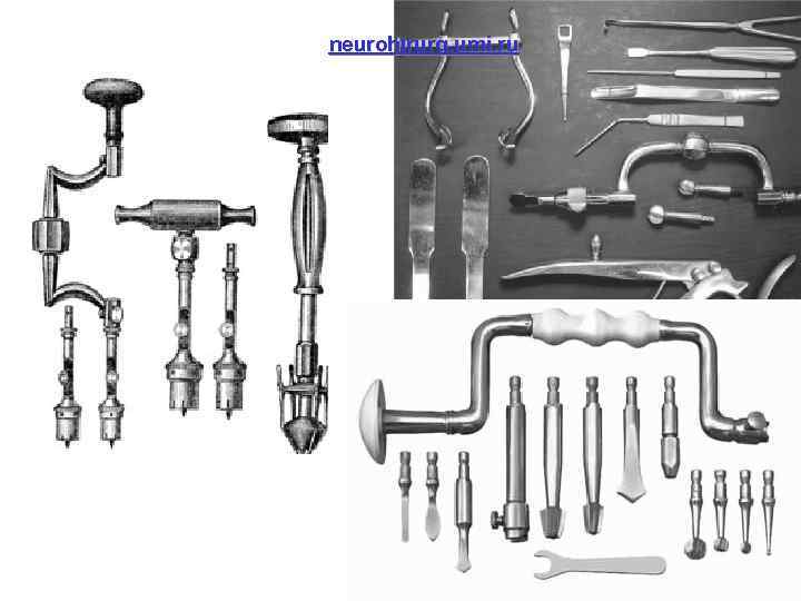 neurohirurg. umi. ru 