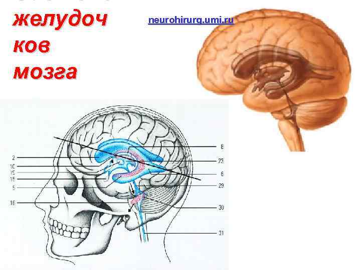 Система желудоч ков мозга neurohirurg. umi. ru 