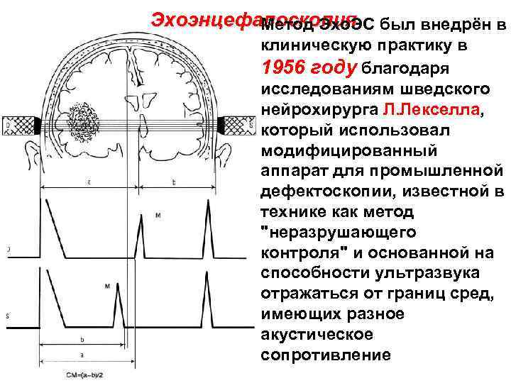Эхоэнцефалоскопия был внедрён в Метод Эхо. ЭС клиническую практику в 1956 году благодаря исследованиям