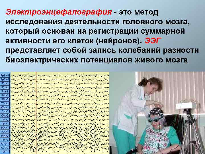 Электроэнцефалография - это метод исследования деятельности головного мозга, который основан на регистрации суммарной активности