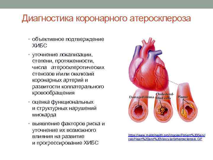 Диагностика коронарного атеросклероза • объективное подтверждение ХИБС • уточнение локализации, степени, протяженности, числа атеросклеротических