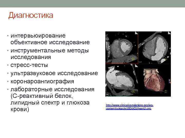 Диагностика • интервьюирование объективное исследование • инструментальные методы исследования • стресс-тесты • ультразвуковое исследование