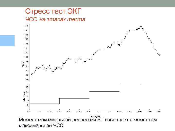 Стресс тест ЭКГ ЧСС на этапах теста Момент максимальной депрессии ST совпадает с моментом