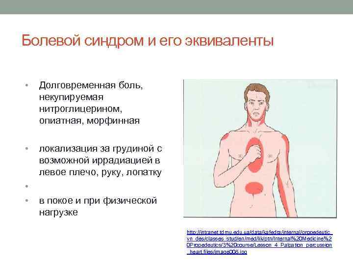 Болевой синдром и его эквиваленты • Долговременная боль, некупируемая нитроглицерином, опиатная, морфинная • локализация