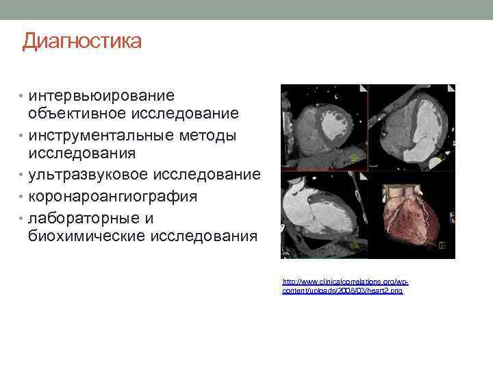 Диагностика • интервьюирование объективное исследование • инструментальные методы исследования • ультразвуковое исследование • коронароангиография