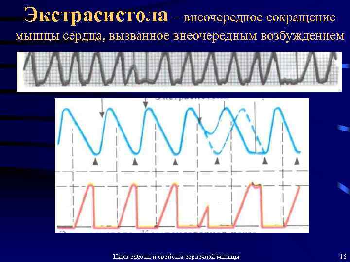 Экстрасистола – внеочередное сокращение мышцы сердца, вызванное внеочередным возбуждением Цикл работы и свойства сердечной