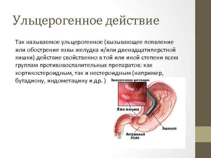 Ульцерогенное действие Так называемое ульцерогенное (вызывающее появление или обострение язвы желудка и/или двенадцатиперстной кишки)