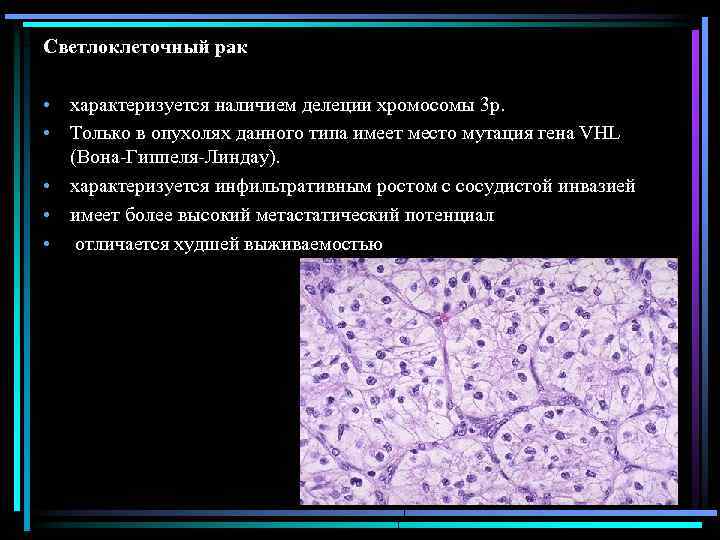 Светлоклеточный рак • характеризуется наличием делеции хромосомы 3 р. • Только в опухолях данного