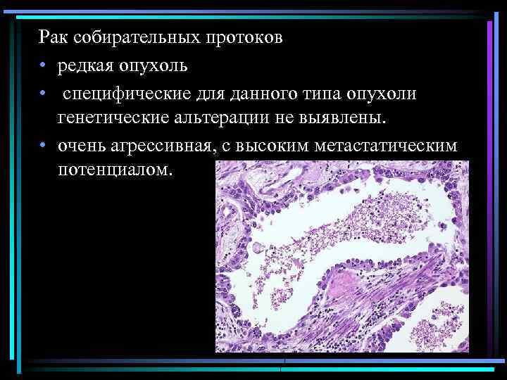 Рак собирательных протоков • редкая опухоль • специфические для данного типа опухоли генетические альтерации