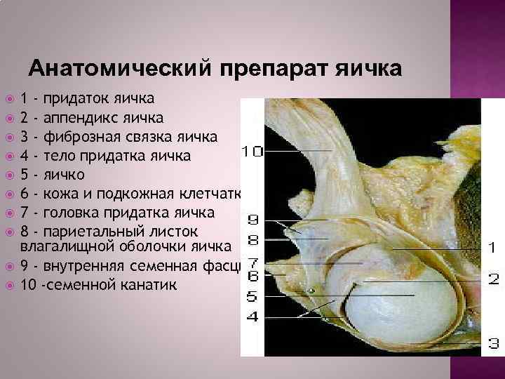 Анатомический препарат яичка 1 - придаток яичка 2 - аппендикс яичка 3 - фиброзная