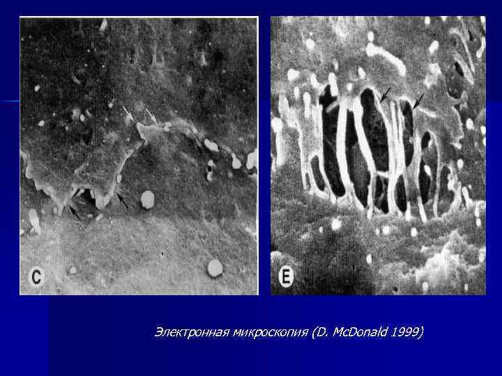 Электронная микроскопия (D. Mc. Donald 1999) 