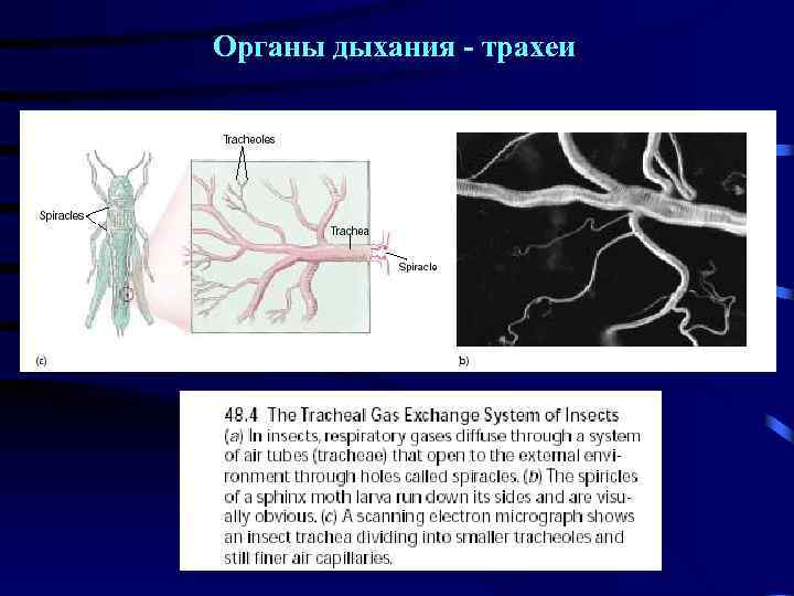 Органы дыхания - трахеи 