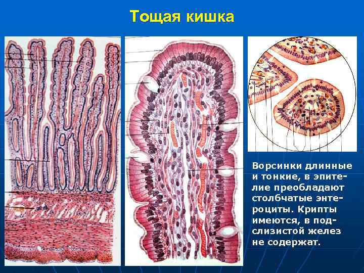 Тощая кишка Ворсинки длинные и тонкие, в эпителие преобладают столбчатые энтероциты. Крипты имеются, в