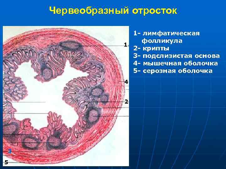 Червеобразный отросток 1 - лимфатическая фолликула 1 2 - крипты 3 - подслизистая основа