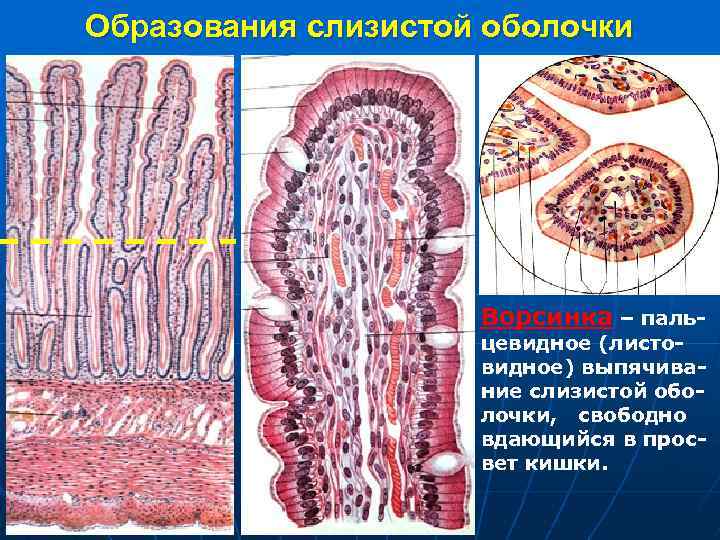 Образования слизистой оболочки Ворсинка – паль- цевидное (листовидное) выпячивание слизистой оболочки, свободно вдающийся в