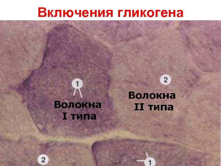 Включения гликогена Волокна I типа Волокна II типа 