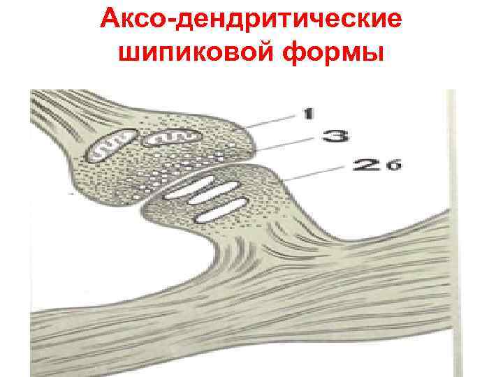 Аксо-дендритические шипиковой формы 