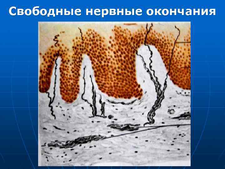 Свободные нервные окончания 