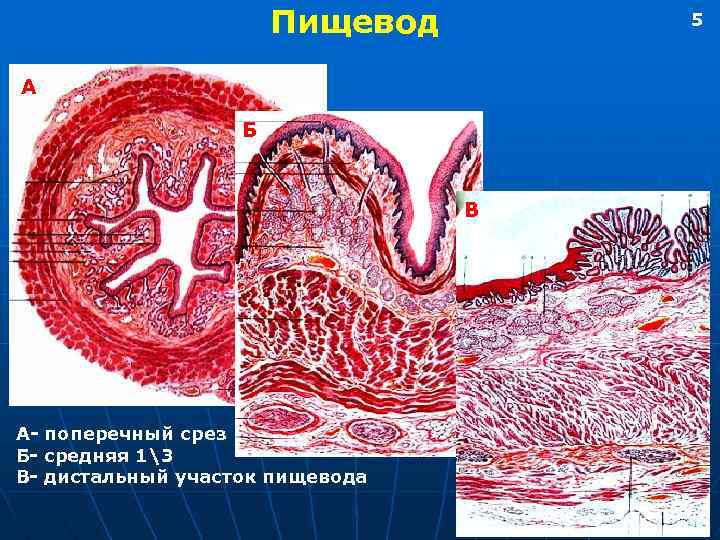 Пищевод 5 А Б В А- поперечный срез Б- средняя 13 В- дистальный участок