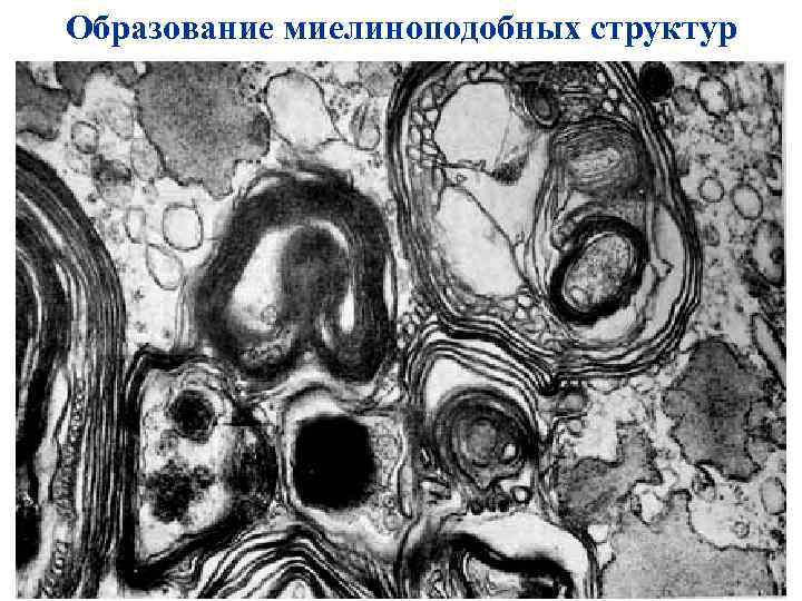 Образование миелиноподобных структур 