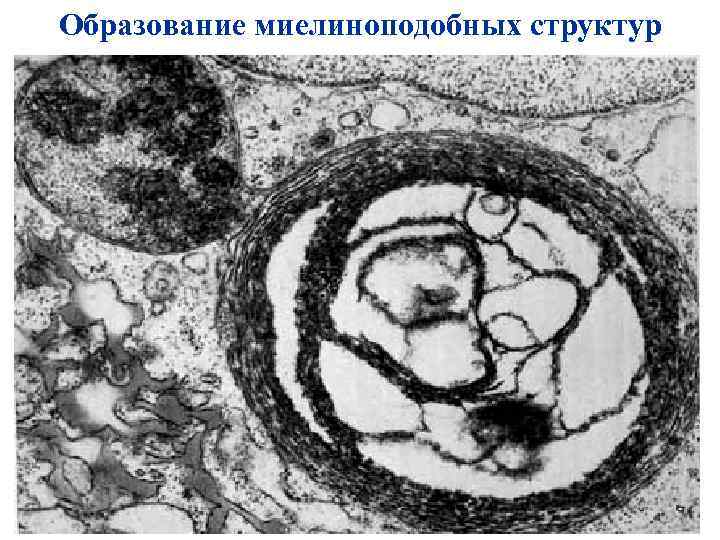 Образование миелиноподобных структур 